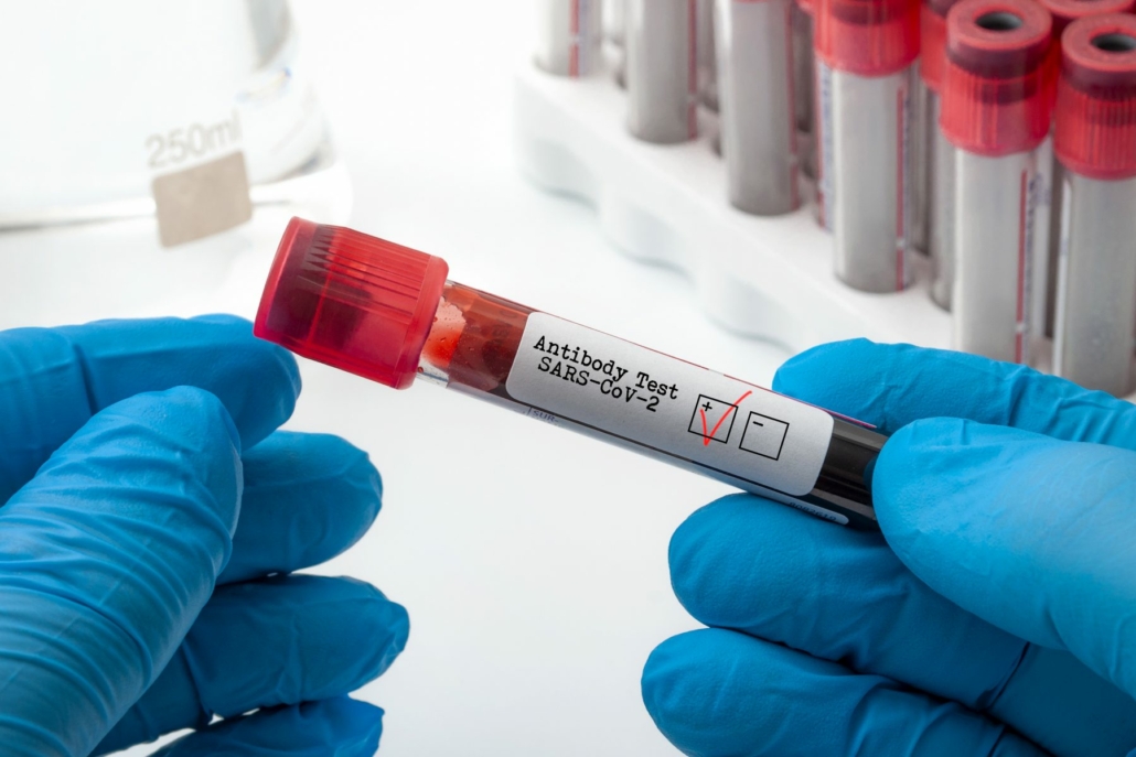 Fusion Antibodies make key Covid-19 Reagents available featured image